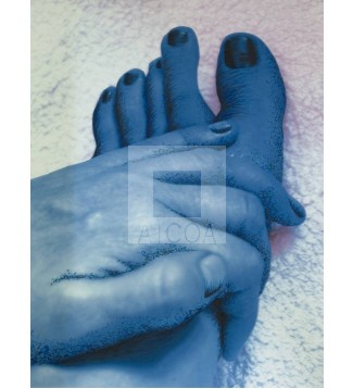 Heridas del cuerpo, Serie 1, Obra 2